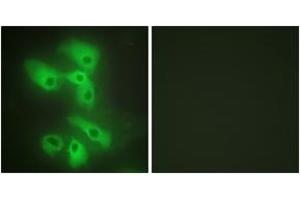 Immunofluorescence analysis of HeLa cells, using JIP2 Antibody. (IB2 antibody  (AA 581-630))