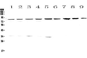 Western blot analysis of CD2AP using anti-CD2AP antibody .