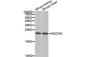 Western blot analysis of extracts of various cell lines, using MECOM antibody. (MECOM antibody)