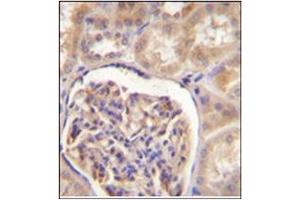 Immunohistochemistry analysis in formalin fixed and paraffin embedded human kidney tissue stained with CYP27B1 Antibody (C-term) Cat. (CYP27B1 antibody  (C-Term))