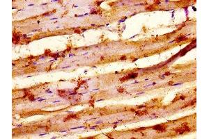 IHC image of ABIN7155352 diluted at 1:500 and staining in paraffin-embedded human skeletal muscle tissue performed on a Leica BondTM system. (MYSM1 antibody  (AA 170-311))