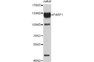 Western blot analysis of extracts of Jurkat cells, using PARP1 antibody (ABIN5995673) at 1/1000 dilution. (PARP1 antibody)