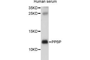 Western blot analysis of extracts of human serum, using PPBP antibody (ABIN5970990) at 1/1000 dilution. (CXCL7 antibody)