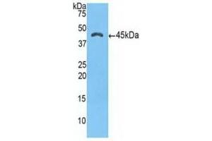 Detection of Recombinant a1ACT, Human using Polyclonal Antibody to Alpha-1-Antichymotrypsin (a1ACT) (SERPINA3 antibody  (AA 235-394))