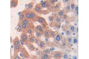 Figure. (PFKL antibody  (AA 2-390))