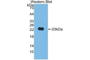 Western Blotting (WB) image for anti-Junctional Adhesion Molecule 2 (JAM2) (AA 74-250) antibody (ABIN1868793) (JAM2 antibody  (AA 74-250))