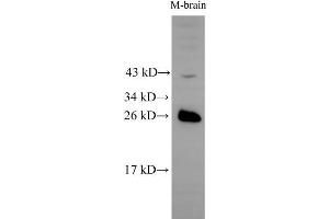 Western Blot analysis of Mouse brain tissue using RAB5B Polyclonal Antibody at dilution of 1:500
