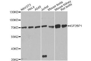 Western blot analysis of extracts of various cell lines, using IGF2BP1 antibody. (IGF2BP1 antibody)