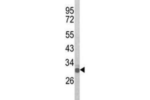 OLIG3 antibody  (AA 74-100)