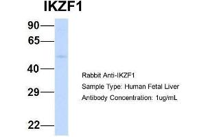 Host:  Rabbit  Target Name:  IKZF1  Sample Type:  Human Fetal Liver  Antibody Dilution:  1. (IKZF1 antibody  (Middle Region))