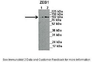 Lanes:   1. (ZEB1 antibody  (N-Term))