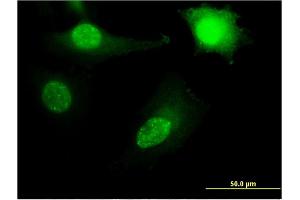 Immunofluorescence of monoclonal antibody to RPL11 on HeLa cell. (RPL11 antibody  (AA 1-177))