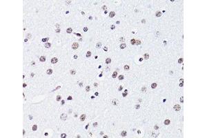 Immunohistochemistry (Paraffin-embedded Sections) (IHC (p)) image for anti-Histone H2B (acLys15) antibody (ABIN7258526)