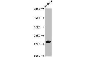Western Blot Positive WB detected in: Mouse kidney tissue All lanes: NAA38 antibody at 4 μg/mL Secondary Goat polyclonal to rabbit IgG at 1/50000 dilution Predicted band size: 14, 19 kDa Observed band size: 19 kDa (NAA38 antibody  (AA 2-173))