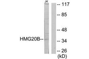 Western blot analysis of extracts from Jurkat cells, using HMG20B Antibody. (HMG20B antibody  (AA 1-50))