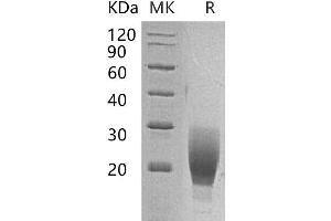 Western Blotting (WB) image for Interleukin 1 Receptor, Type I (IL1R1) protein (Fc Tag) (ABIN7320550) (IL1R1 Protein (Fc Tag))