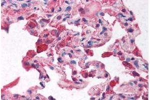 Human Lung (formalin-fixed, paraffin-embedded) stained with NCOR2 antibody ABIN214126 at 5 ug/ml followed by biotinylated goat anti-rabbit IgG secondary antibody ABIN481713, alkaline phosphatase-streptavidin and chromogen. (NCOR2 antibody  (AA 511-560))