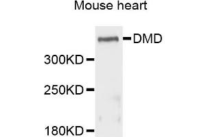 Western blot analysis of extracts of mouse heart cells, using DMD antibody. (Dystrophin antibody)