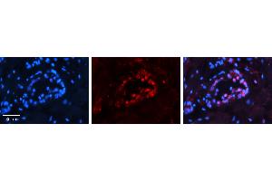 Rabbit Anti-PAX8 Antibody   Formalin Fixed Paraffin Embedded Tissue: Human Thyroid Tissue Observed Staining: Nucleus in follicular cells Primary Antibody Concentration: 1:100 Other Working Concentrations: 1:600 Secondary Antibody: Donkey anti-Rabbit-Cy3 Secondary Antibody Concentration: 1:200 Magnification: 20X Exposure Time: 0. (PAX8 antibody  (N-Term))