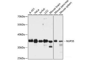 Western blot analysis of extracts of various cell lines using NUP35 Polyclonal Antibody at dilution of 1:3000. (NUP35 antibody)