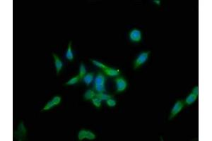 Immunofluorescence staining of PC-3 cells with ABIN7157267 at 1:133, counter-stained with DAPI. (KLHL12 antibody  (AA 1-220))