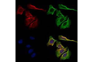 ABIN7093128 and ABIN7098914 staining Hela cells by IF/ICC. (kappa Light Chain antibody  (Internal Region, Light Chain))