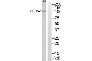 Western blot analysis of extracts from COLO205 and Jurkat cells, using EPHA2 antibody. (EPH Receptor A2 antibody  (N-Term))