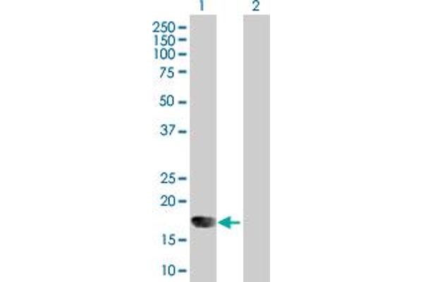 IFNA6 anticorps  (AA 1-189)