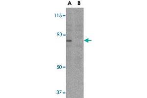 Western blot analysis of AICDA in Ramos whole cell lysate with AICDA polyclonal antibody  at 2 ug/mL in either the (A) absence or (B) presence of blocking peptide. (AICDA antibody  (C-Term))