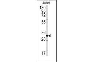 Western blot analysis of anti-CDK2 Antibody (C-term) in Jurkat cell line lysates (35ug/lane). (CDK2 antibody  (C-Term))