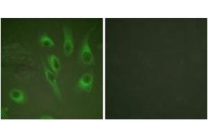 Immunofluorescence analysis of HeLa cells, using Calnexin (Phospho-Ser583) Antibody.