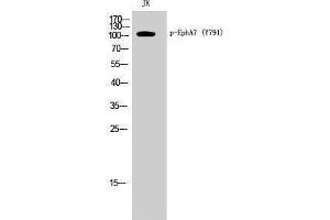 Western Blotting (WB) image for anti-EPH Receptor A7 (EPHA7) (pTyr791) antibody (ABIN3182396) (EPH Receptor A7 antibody  (pTyr791))