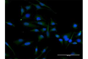 Immunofluorescence of purified MaxPab antibody to CCND2 on HeLa cell. (Cyclin D2 antibody  (AA 1-289))