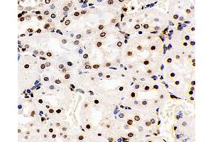 Immunohistochemistry analysis of paraffin-embedded Rat kidney using S100A4 Polyclonal Antibody at dilution of 1:400. (s100a4 antibody)