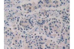 Immunohistochemistry (IHC) image for anti-Glutathione Reductase (GSR) (AA 44-522) antibody (ABIN7433438)