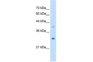 WB Suggested Anti-CACYBP Antibody Titration:  5. (CACYBP antibody  (Middle Region))