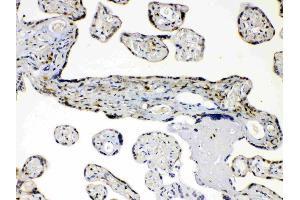 AKR1B1 was detected in paraffin-embedded sections of human placenta tissues using rabbit anti- AKR1B1 Antigen Affinity purified polyclonal antibody (Catalog # ) at 1 ? (AKR1B1 antibody  (AA 228-316))