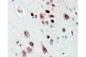 IHC staining of FFPE human cerebral cortex with NOVA1 antibody at 2. (NOVA1 antibody)