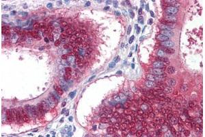Human Uterus: Formalin-Fixed, Paraffin-Embedded (FFPE) (YAP1 antibody  (AA 53-162))