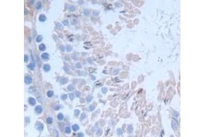Figure. (Selenoprotein W antibody  (AA 1-86))