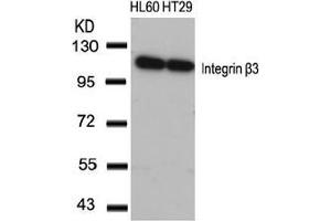 Image no. 3 for anti-Integrin beta 3 (ITGB3) (AA 771-775) antibody (ABIN197246) (Integrin beta 3 antibody  (AA 771-775))