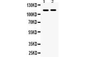 Anti- Eph receptor A5 Picoband antibody, Western blottingAll lanes: Anti Eph receptor A5  at 0. (EPH Receptor A5 antibody  (C-Term))