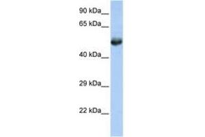 Image no. 1 for anti-Friend Leukemia Virus Integration 1 (FLI1) (AA 360-409) antibody (ABIN6744407) (FLI1 antibody  (AA 360-409))