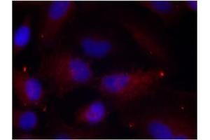Image no. 1 for anti-P21-Activated Kinase 1 (PAK1) (pThr402), (pThr421), (pThr423) antibody (ABIN196896) (PAK1 antibody  (pThr402, pThr421, pThr423))