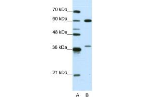 WB Suggested Anti-HNRPL Antibody Titration:  0. (HNRNPL antibody  (N-Term))