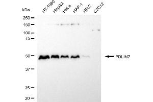 Western blotting analysis using PDLIM7 antibody (ABIN7799751).