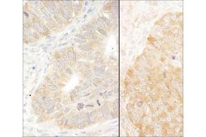 anti-eIF2 alpha/eif2s1 (C-Term) antibody