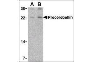 Image no. 4 for anti-Cerebellin 1 Precursor (CBLN1) (Middle Region) antibody (ABIN303204) (CBLN1 antibody  (Middle Region))