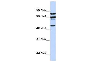 Western Blotting (WB) image for anti-Protein Phosphatase 4, Regulatory Subunit 2 (PPP4R2) antibody (ABIN2458684) (PPP4R2 antibody)