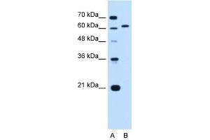 Lamin B2 antibody used at 0. (Lamin B2 antibody  (N-Term))